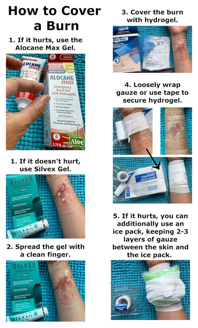 how to cover a kitchen cooking burn