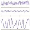 brainwave chart